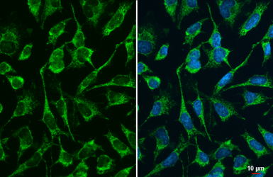 Anti-DLST antibody used in Immunocytochemistry/ Immunofluorescence (ICC/IF). GTX134855