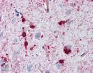 Anti-alpha B Crystallin antibody used in Immunohistochemistry (IHC). GTX13497
