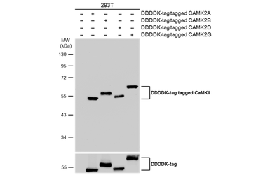 Anti-CaMKII antibody used in Western Blot (WB). GTX135117