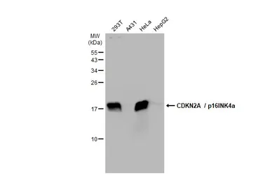 Anti-CDKN2A / p16INK4a antibody used in Western Blot (WB). GTX135120