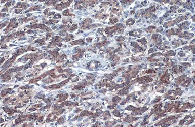 Anti-CDKN2A / p16INK4a antibody used in IHC (Paraffin sections) (IHC-P). GTX135120