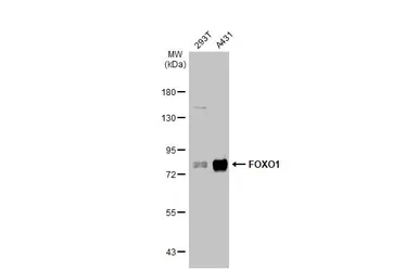 Anti-FOXO1 antibody used in Western Blot (WB). GTX135251