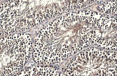Anti-FOXO1 antibody used in IHC (Paraffin sections) (IHC-P). GTX135251