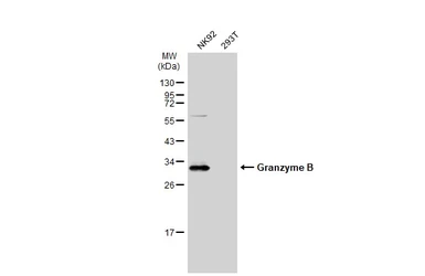 Anti-Granzyme B antibody used in Western Blot (WB). GTX135274