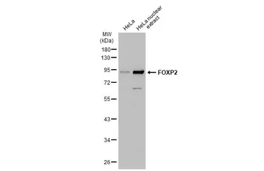 Anti-FOXP2 antibody used in Western Blot (WB). GTX135285