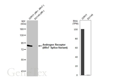Anti-Androgen Receptor (ARv7 Splice Variant) antibody used in Western Blot (WB). GTX135345