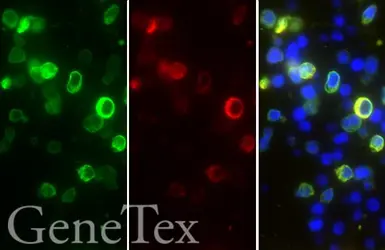 Anti-SARS-CoV-2 (COVID-19) Nucleocapsid antibody used in IHC-P (cell pellet) (IHC-P (cell pellet)). GTX135357