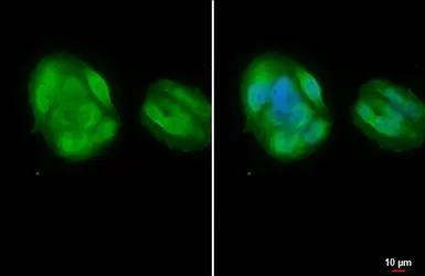 Anti-Steroidogenic Factor 1 antibody used in Immunocytochemistry/ Immunofluorescence (ICC/IF). GTX135635