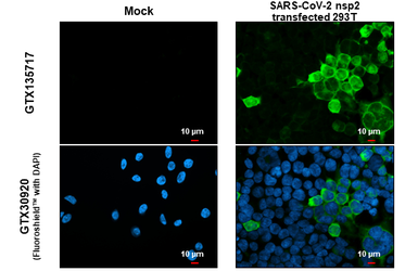 Anti-SARS-CoV-2 (COVID-19) nsp2 antibody used in Immunocytochemistry/ Immunofluorescence (ICC/IF). GTX135717