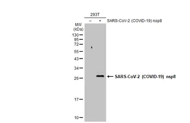 Anti-SARS-CoV-2 (COVID-19) nsp8 antibody used in Western Blot (WB). GTX135729