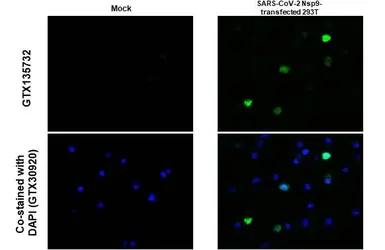 Anti-SARS-CoV-2 (COVID-19) nsp9 antibody used in IHC-P (cell pellet) (IHC-P (cell pellet)). GTX135732