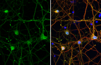 Anti-Tau (phospho Thr217) antibody used in Immunocytochemistry/ Immunofluorescence (ICC/IF). GTX135775
