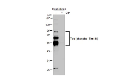 Anti-Tau (phospho Thr181) antibody used in Western Blot (WB). GTX135776