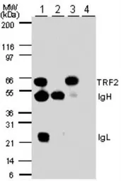Anti-TRF2 antibody used in Immunoprecipitation (IP). GTX13589