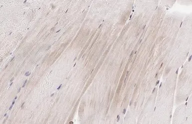 Anti-MURF1 antibody used in IHC (Paraffin sections) (IHC-P). GTX135929