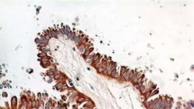 Anti-NFkB p65 antibody [112A1021] used in IHC (Paraffin sections) (IHC-P). GTX13594