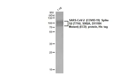 SARS-CoV-2 (COVID-19) Spike S2 (ECD) Protein, B.1.1.7 / Alpha variant, His tag. GTX136023-pro