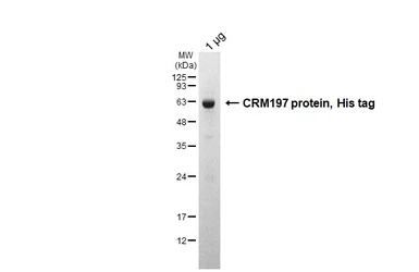 CRM197 protein, His tag. GTX136284-pro