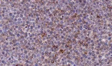 Anti-Noxa antibody [114C307.1] used in IHC (Paraffin sections) (IHC-P). GTX13654