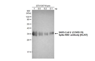 SARS-CoV-2 (COVID-19) Spike RBD Protein, Omicron / BA.1 variant, His tag. GTX136716-pro