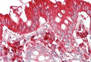 Anti-TFB2M antibody, C-term used in IHC (Paraffin sections) (IHC-P). GTX13676