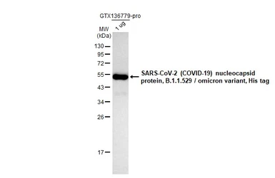 SARS-CoV-2 (COVID-19) Nucleocapsid protein, Omicron / BA.1 variant, His tag. GTX136779-pro