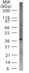 Anti-ASB11 antibody used in Western Blot (WB). GTX13711