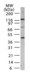 Anti-SMAD1+5+8(9) antibody used in Western Blot (WB). GTX13724