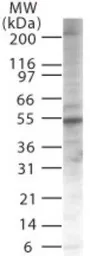 Anti-PIASy antibody used in Western Blot (WB). GTX13795
