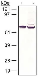 Anti-RPE65 antibody [401.8B11.3D9] used in Western Blot (WB). GTX13826