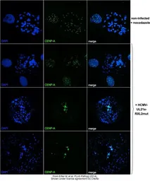 Anti-CENPA antibody [3-19] used in Immunocytochemistry/ Immunofluorescence (ICC/IF). GTX13939