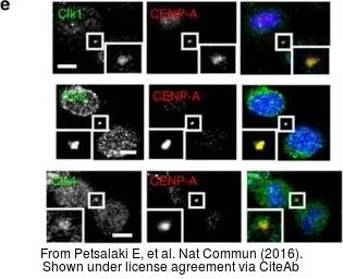 Anti-CENPA antibody [3-19] used in Immunocytochemistry/ Immunofluorescence (ICC/IF). GTX13939