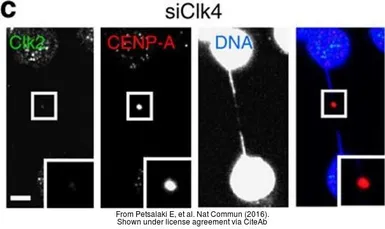 Anti-CENPA antibody [3-19] used in Immunocytochemistry/ Immunofluorescence (ICC/IF). GTX13939