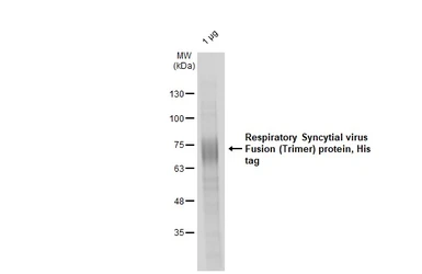 Respiratory Syncytial virus Fusion (Trimer) protein, His tag. GTX139646-pro