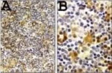 Anti-Caspase 1 antibody used in IHC (Paraffin sections) (IHC-P). GTX14368