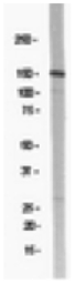 Anti-NMDAR2B antibody used in Western Blot (WB). GTX14400