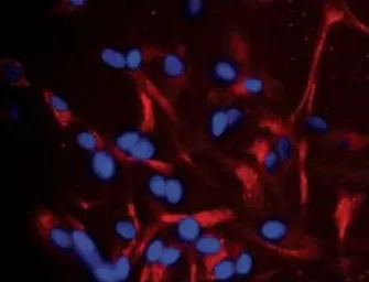 Anti-A2B5 antibody [105] used in Immunocytochemistry/ Immunofluorescence (ICC/IF). GTX14538