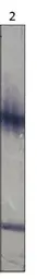 Anti-PDE11A antibody used in Western Blot (WB). GTX14624