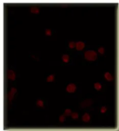 Anti-PDE5A antibody used in Immunocytochemistry/ Immunofluorescence (ICC/IF). GTX14672