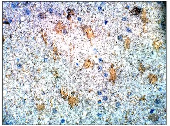 Anti-S100 beta antibody used in IHC (Paraffin sections) (IHC-P). GTX14688