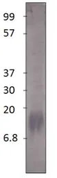 Anti-S100 beta antibody used in Western Blot (WB). GTX14688