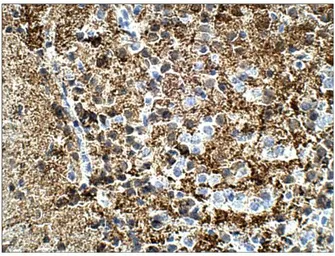 Anti-Calretinin antibody used in IHC (Paraffin sections) (IHC-P). GTX14689
