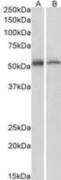 Anti-ETEA antibody, C-term used in Western Blot (WB). GTX14759