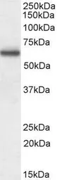 Anti-Coronin 1A antibody used in Western Blot (WB). GTX14787