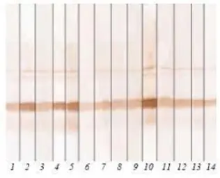 Anti-Calcitonin antibody [13f2] used in Western Blot (WB). GTX14818
