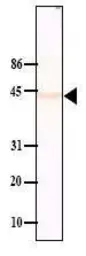 Anti-PPM1A antibody [p6c7] used in Western Blot (WB). GTX14824
