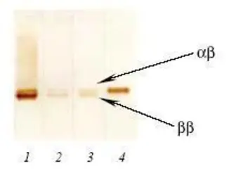 Anti-S100 antibody [4B3] used in Western Blot (WB). GTX14849