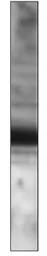 Anti-EFEMP1 antibody used in Western Blot (WB). GTX14926