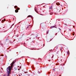 Anti-D4 GDI antibody used in IHC (Paraffin sections) (IHC-P). GTX15198