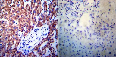 Anti-Presenilin 1 antibody [APS 11] used in IHC (Paraffin sections) (IHC-P). GTX15456